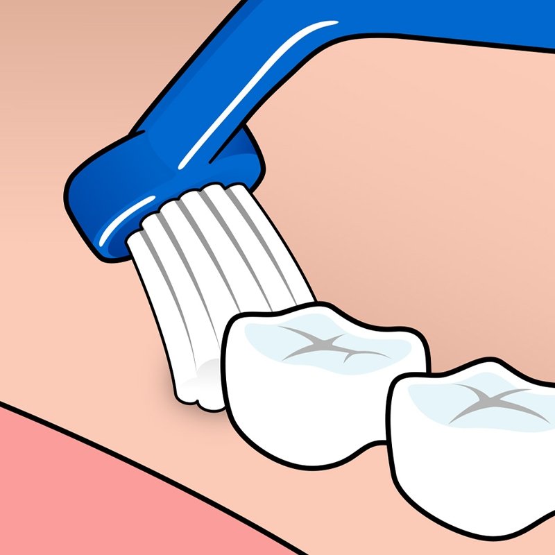 Universal Care Vinklad borste - HemSyd